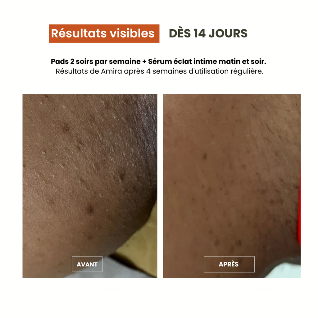 Pads Exfoliants Intime