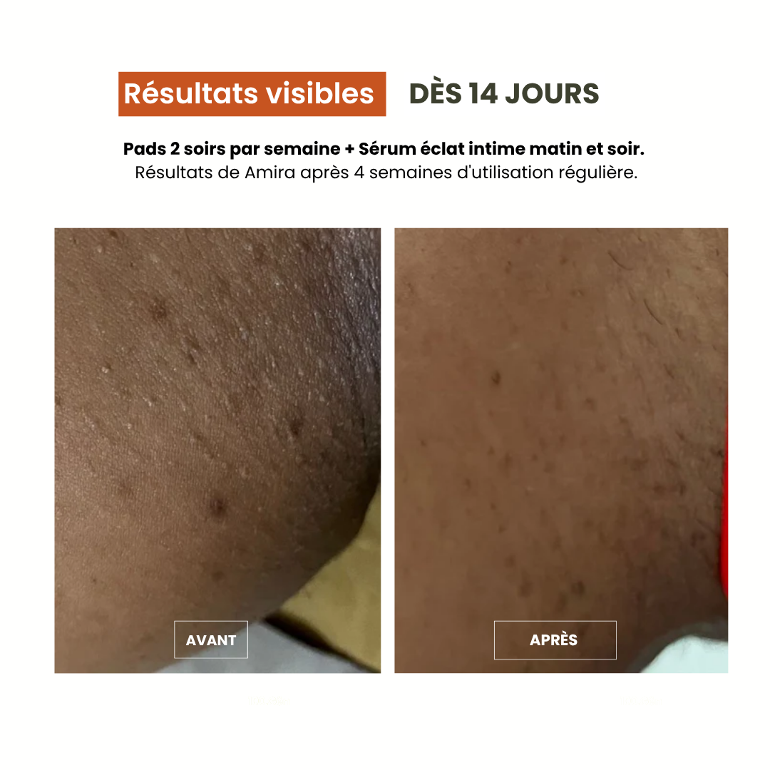 Pads Exfoliants Intime