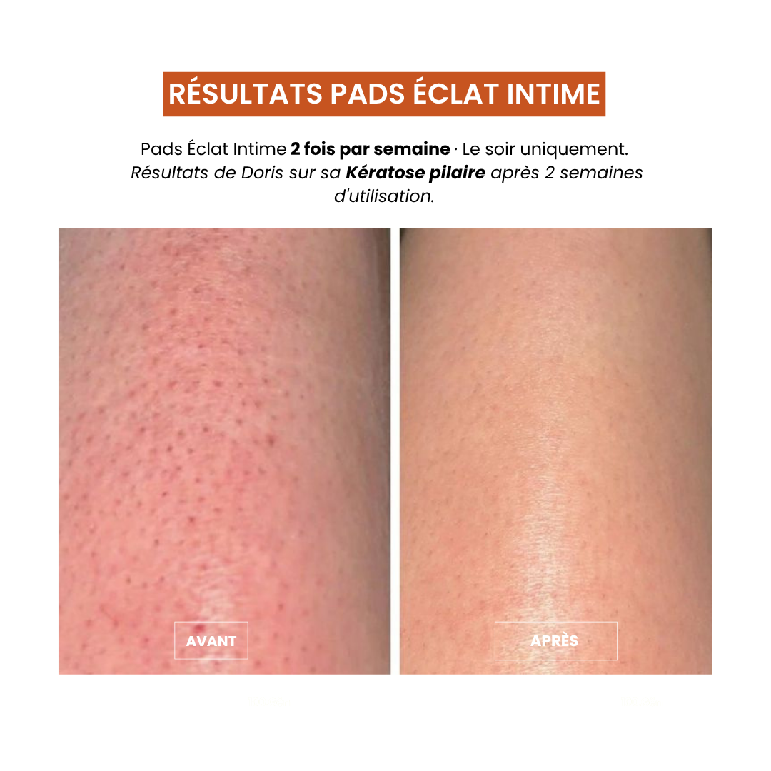 Pads Exfoliants Intime