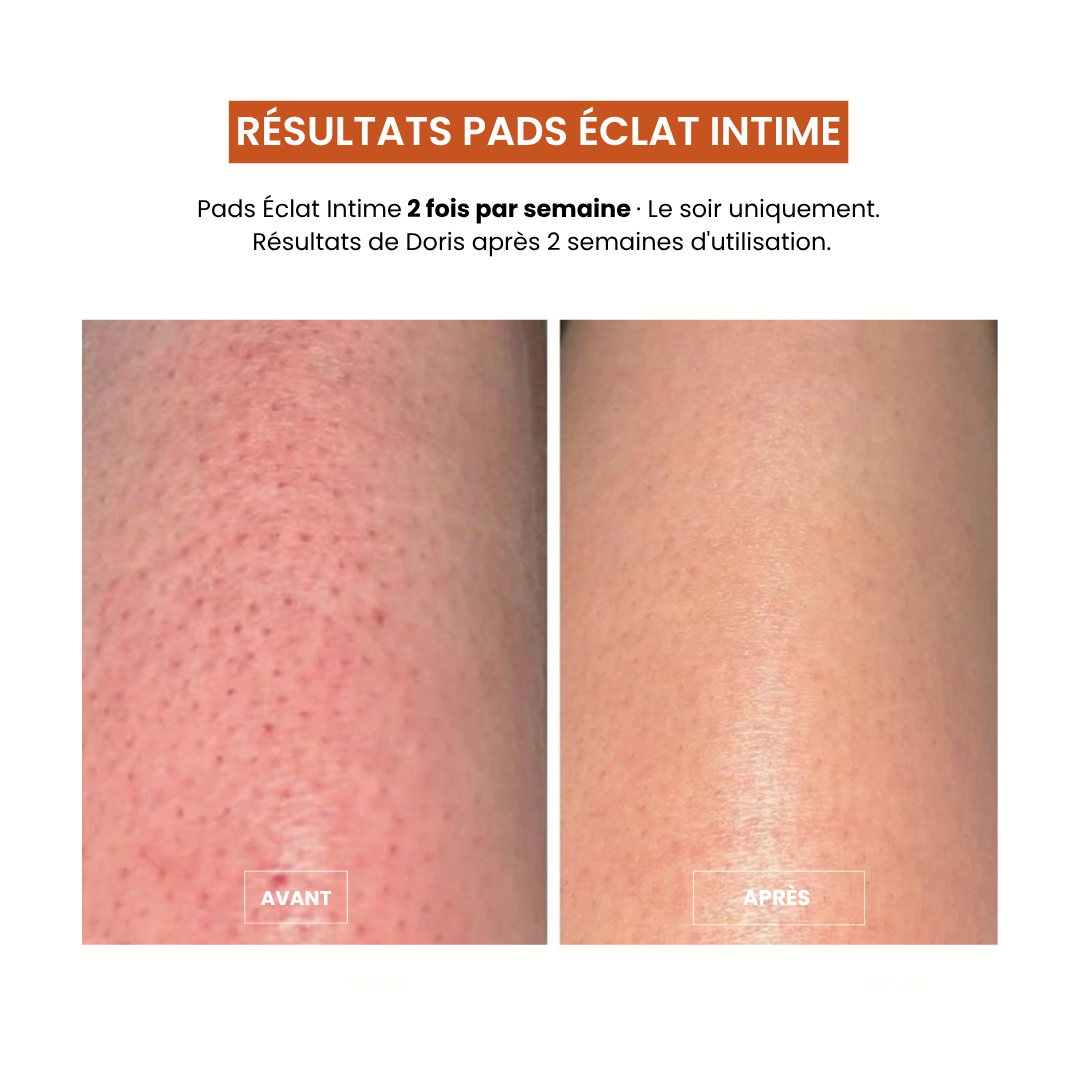Pads Exfoliants Intime