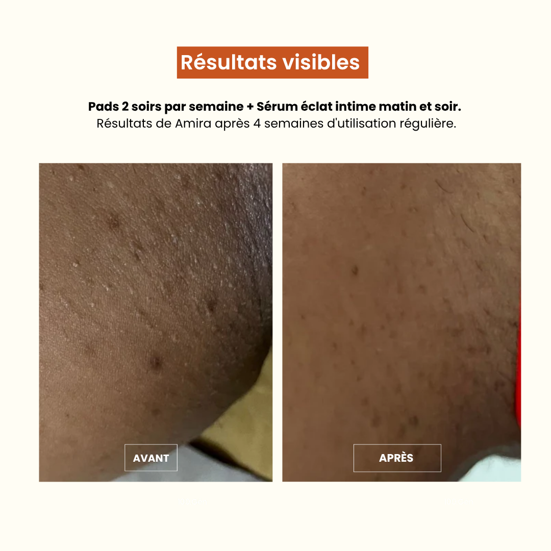 Pads Exfoliants Intime
