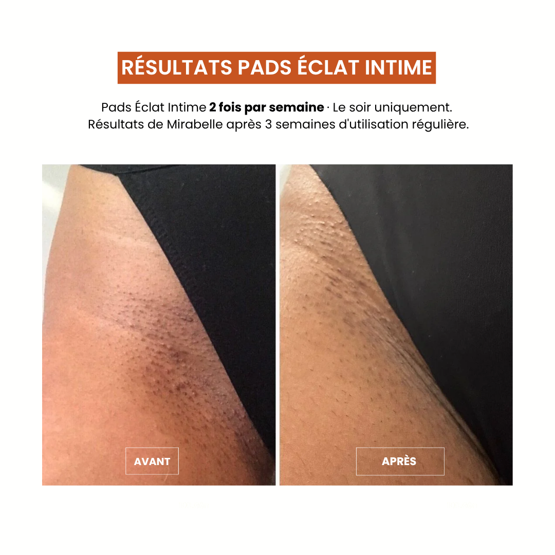 Pads Exfoliants Intime