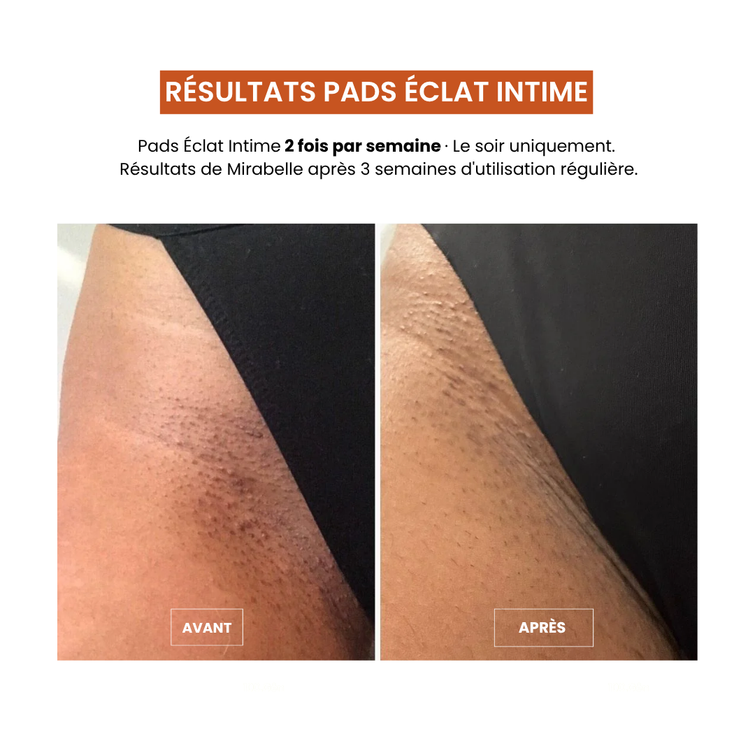 Pads Exfoliants Intime