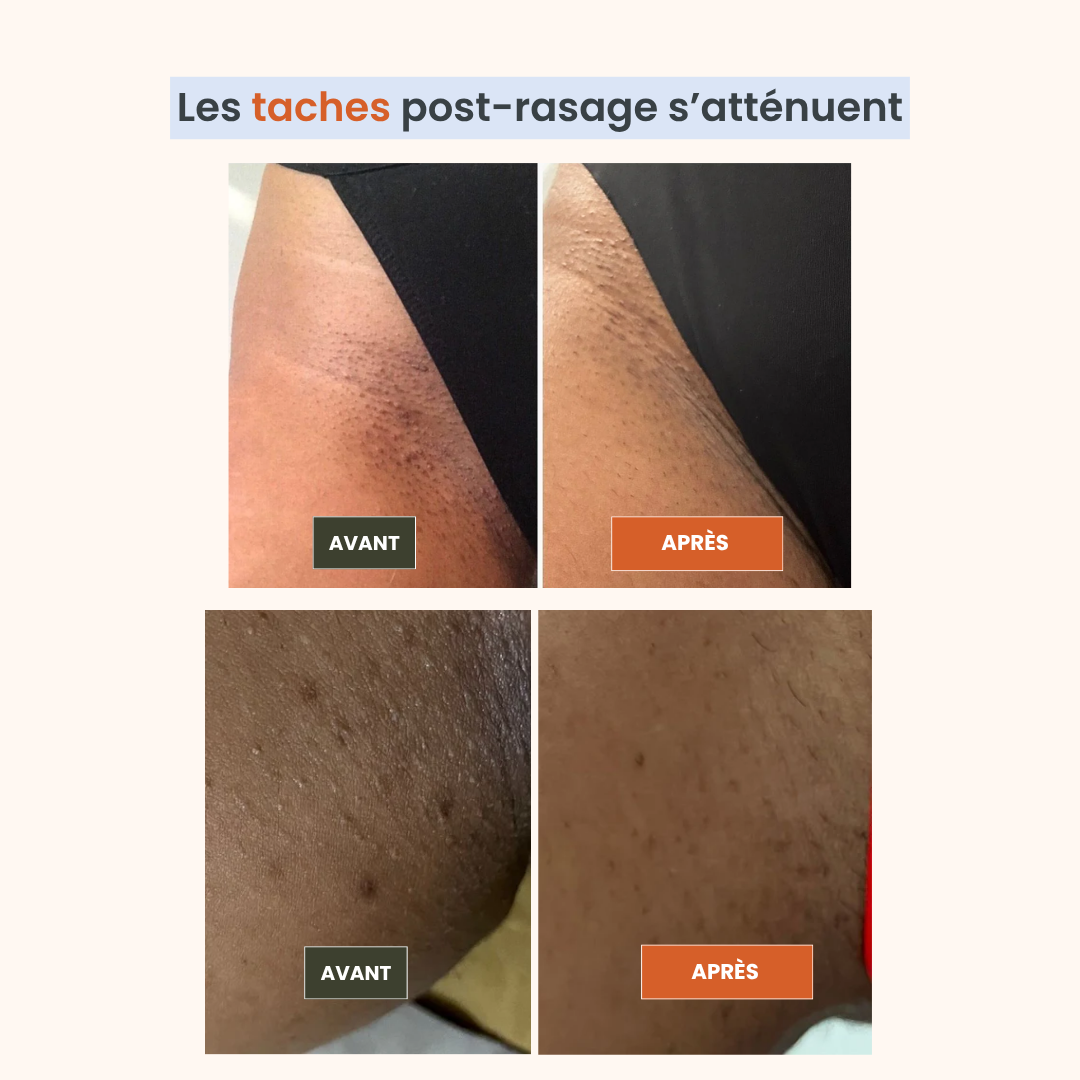 Routine Éclat Intime