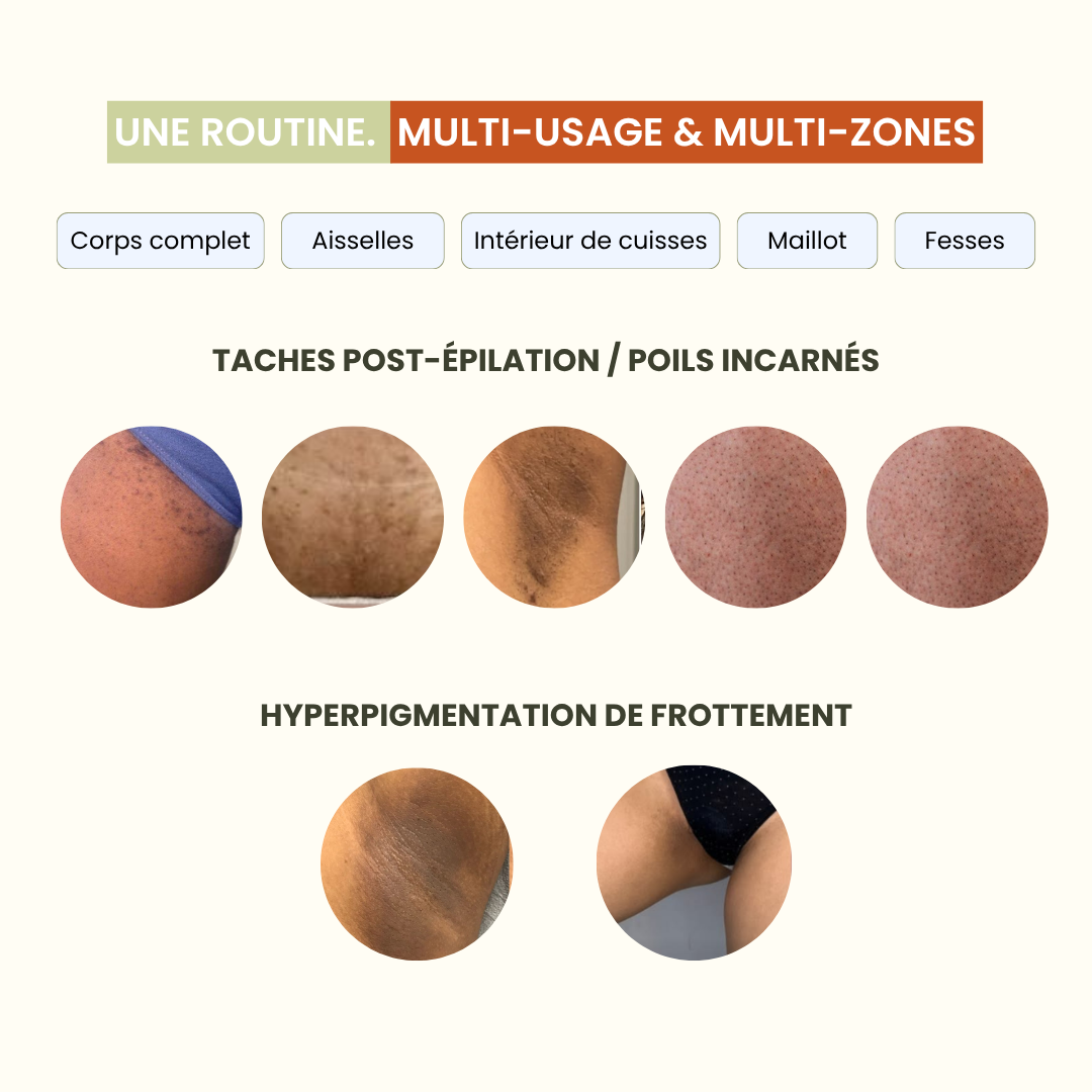 Pads Exfoliants Intime