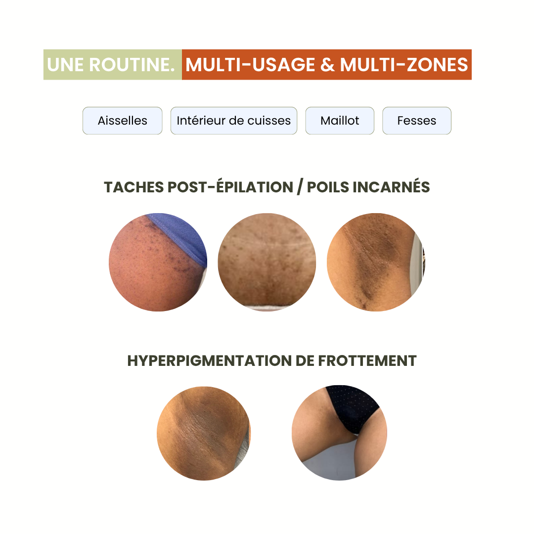 Pads Exfoliants Intime